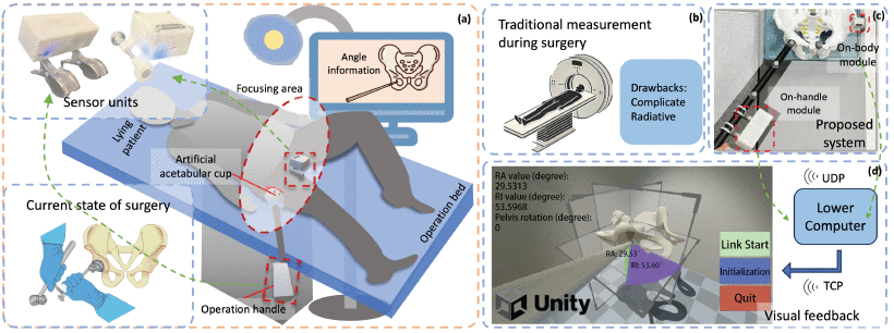 Overall scheme of THA surgeries via DAA.