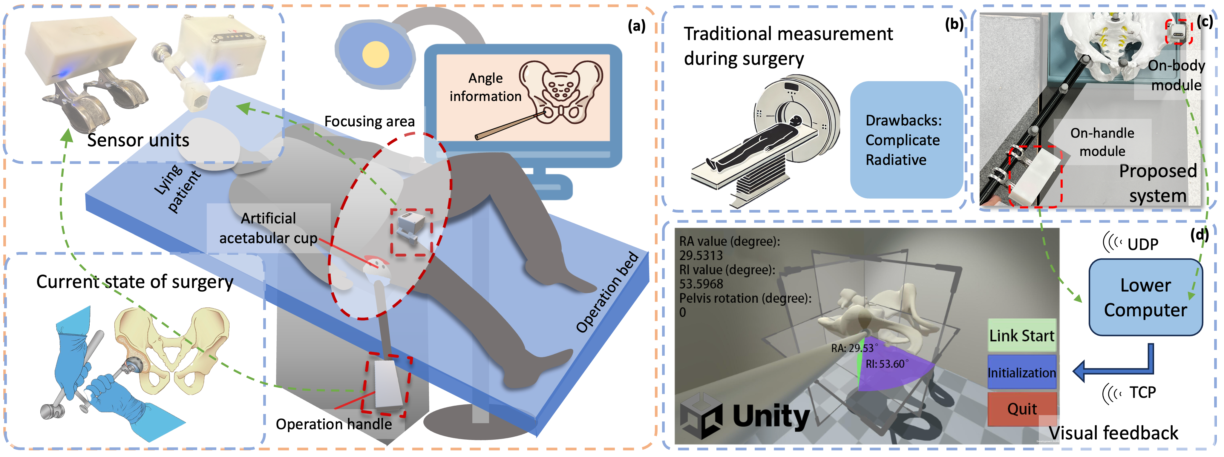 Concept of the INS for THA